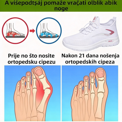 【⏰Posljednji dan, 50% popusta! Ne propustite!】Ergonomski dizajnirane ortopedske cipele s apsorpcijom udaraca, ✅️Zdrave ortopedske cipele posebno dizajnirane za europske žene.